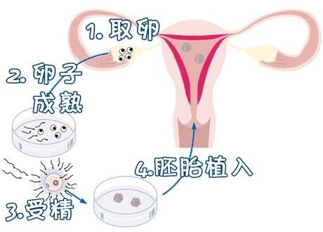 遗传咨询专家